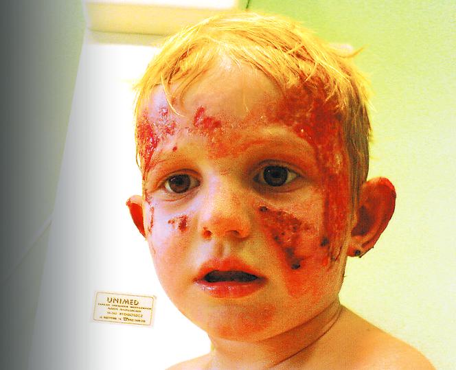 Podczas obiadu wylecieli w powietrze