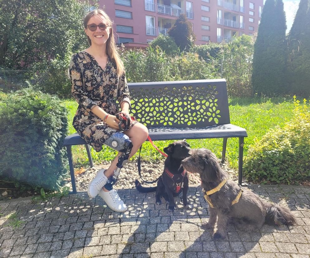 Marlena zbiera na nową protezę