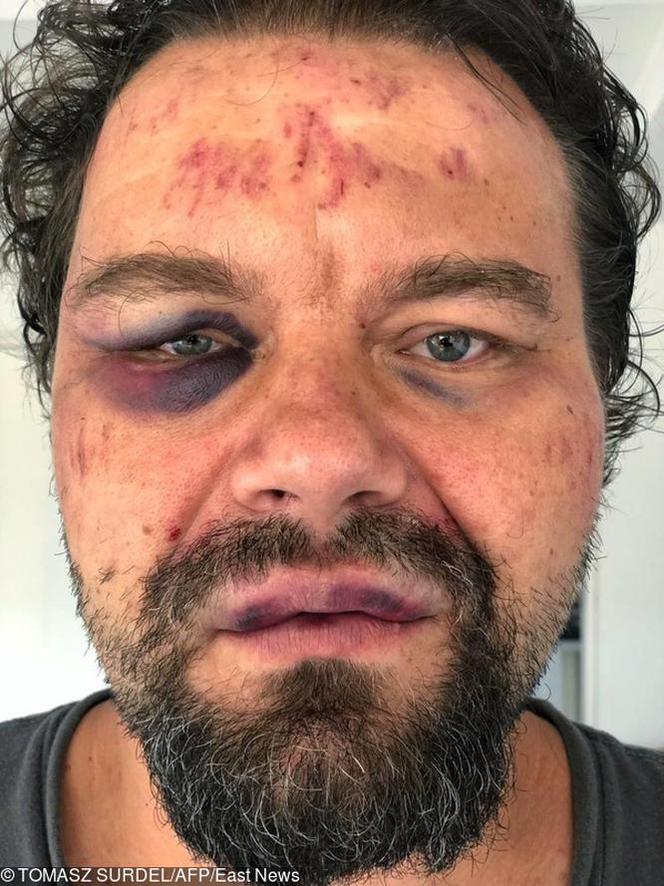 Pobili dziennikarza GW