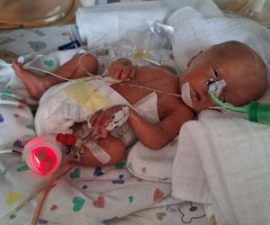 Dzień Wcześniaka w Szpitalu św. Zofii w Warszawie