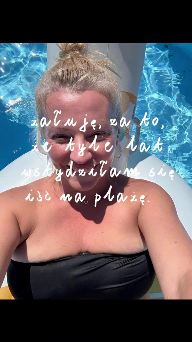 Dorota Szelągowska nie wstydzi się rozstępów