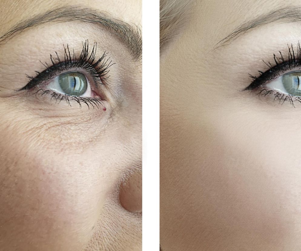  Kosztuje 6 złotych, a daje efekt jak zabieg za 600 zł. Kupisz w sklepie za rogiem