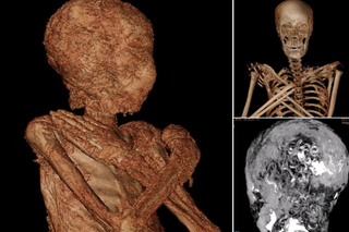 Mumia z Muzeum Narodowego w Warszawie nie ma penisa! Okazała się kobietą!