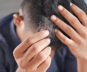 Biotechnolodzy wyhodowali mieszki włosowe. Czy to przełom w leczeniu łysiny?