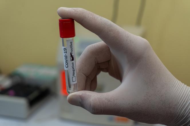 Niemal 8 tys. zakażeń COVID-19. Ministerstwo Zdrowia podało najnowsze dane