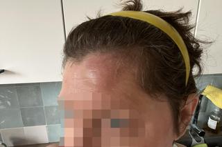 Kobieta pobita przez staruszka, bo zwróciła mu uwagę. Przewrócił mnie na chodnik i okładał parasolką, potem uderzył pięścią w twarz