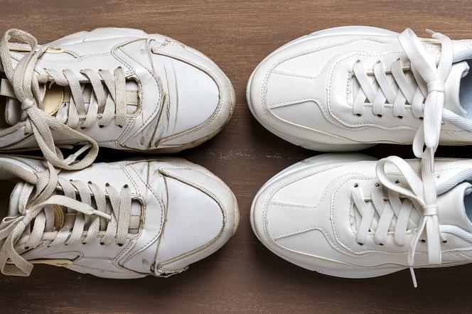 Jak wyczyścić białe buty