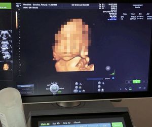 Bruno miał dziś przyjść na świat. Wypadek samochodowy ciężarnej Patrycji w Katowicach