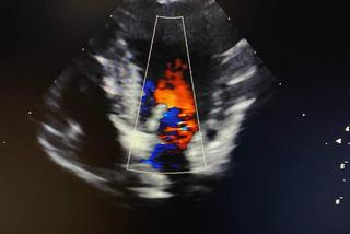 Tofik z chorym serduszkiem