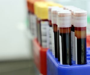 Leukocyty - jakie są normy. Co oznacza niska lub podwyższona zawartość krwinek białych?