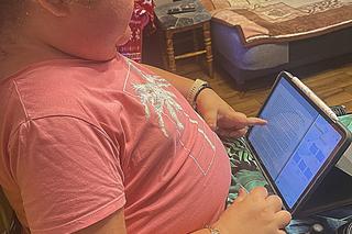 Olę wyniszcza potworna choroba. 23-latka szuka pracy, by zarobić na leczenie