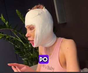 Julia Von Stein po operacji 