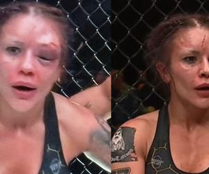 Zmasakrowana twarz zawodniczki PRIME MMA po walce. Porównali ją do... Joanny Jędrzejczyk [ZDJĘCIE]