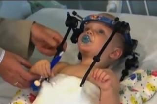 Kręgosłup 1,5-rocznego chłopca oderwał się od czaszki! To CUD! Lekarze go uratowali