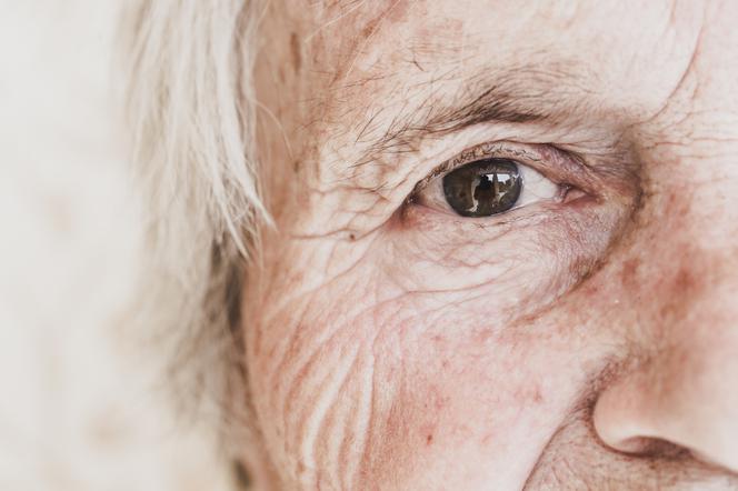 Lek na Alzheimera jest dostępny od dawien dawna? Nowe odkrycie 