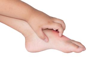 Swędzenie skóry u dziecka - co robić?