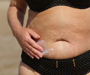 Jak skutecznie i szybko schudnąć przed urlopem? Sprawdzamy, czy to możliwe