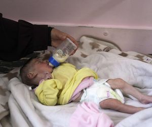 Dramat w Strefie Gazy. Dzieci i seniorzy umierają z głodu. Pomoc ruszyła, ale wciąż jest jej za mało