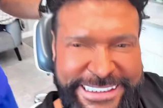 Krzysztof Rutkowski i jego nowe zęby. Zdania fanów? Podzielone