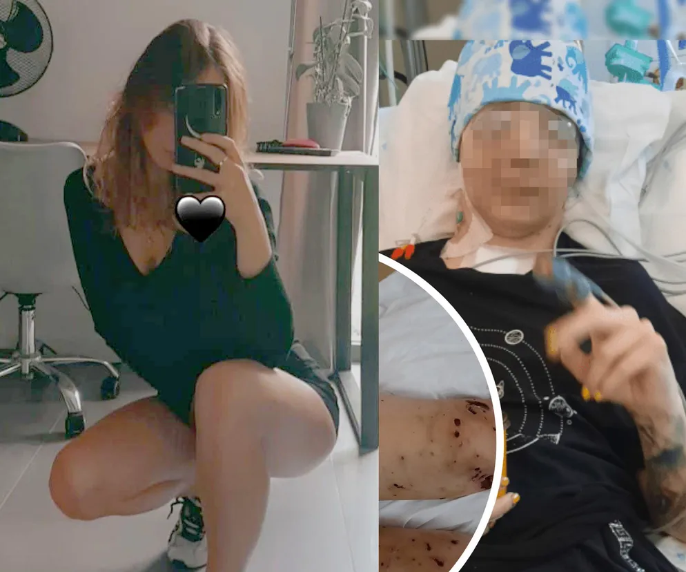 Sfora psów omal nie rozszarpała 18-latki na śmierć. Ich właściciel czeka na decyzję