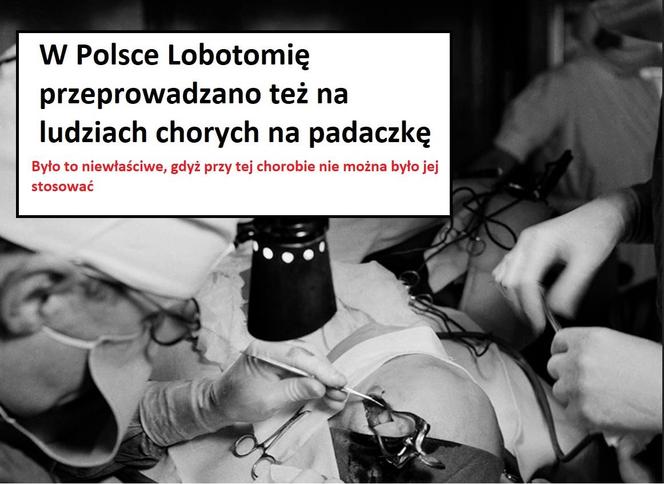 W tych przypadkach stosowano lobotomię