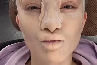 Basia Kurdej-Szatan oszpecona