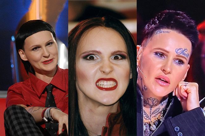 Chylińska nieźle się zmieniła. Duże usta i gładka twarz. Poznajecie ją jeszcze?