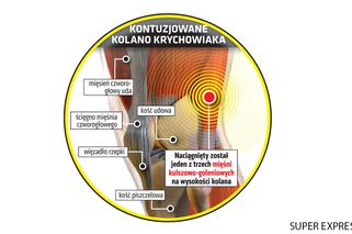 Grzegorz Krychowiak, kontuzja, infofrafika