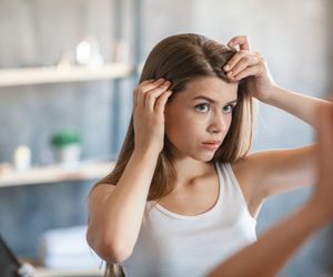 Pryszcze na głowie: jak wyleczyć trądzik we włosach?