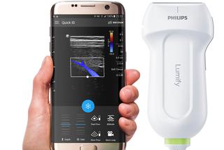 Mobilne USG - jak działa ta nowoczesna wersja ultrasonografii?