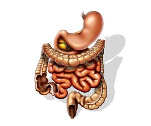 ANGIODYSPLAZJA – choroba naczyniowa JELITA