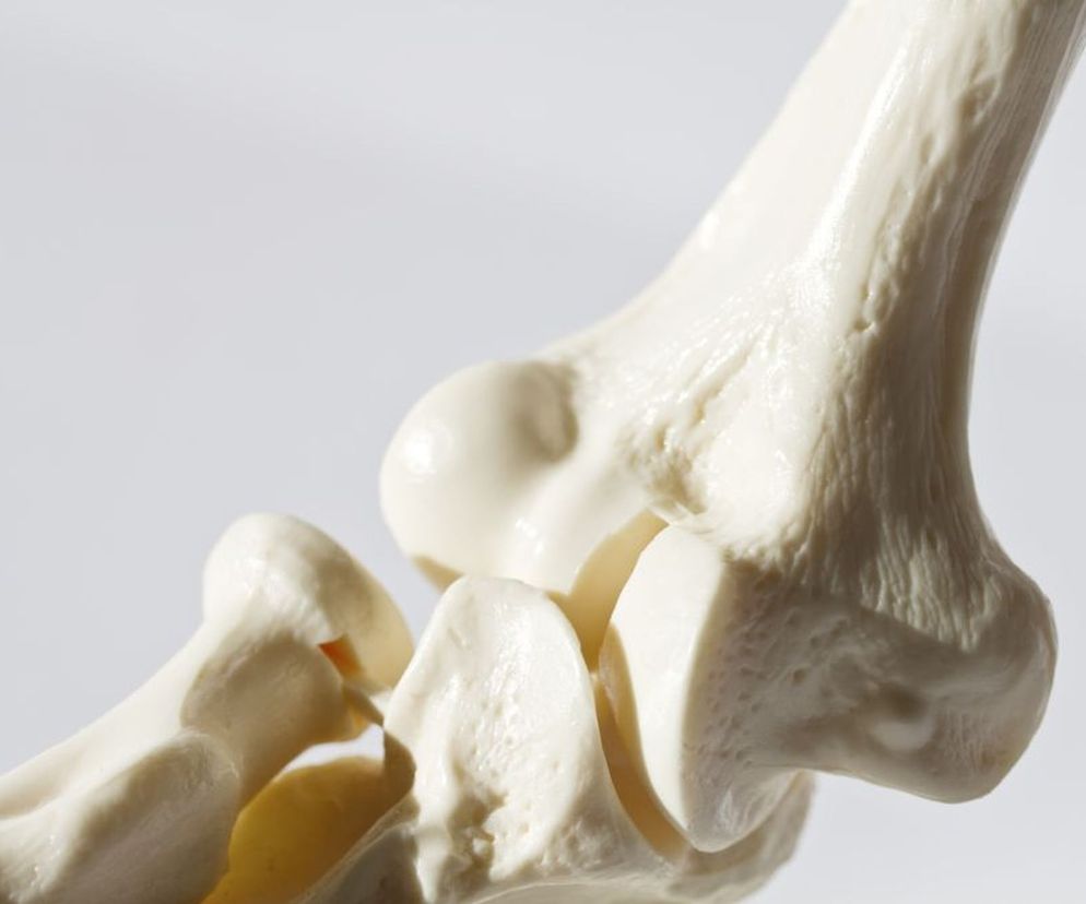 Osteoporozy nie można wyleczyć. Dlatego warto zrobić wszystko, by zapobiec zrzeszotnieniu kości. Recepta na to jest prosta: ruch i odpowiednia dieta, w której nie może zabraknąć wapnia i witaminy D.