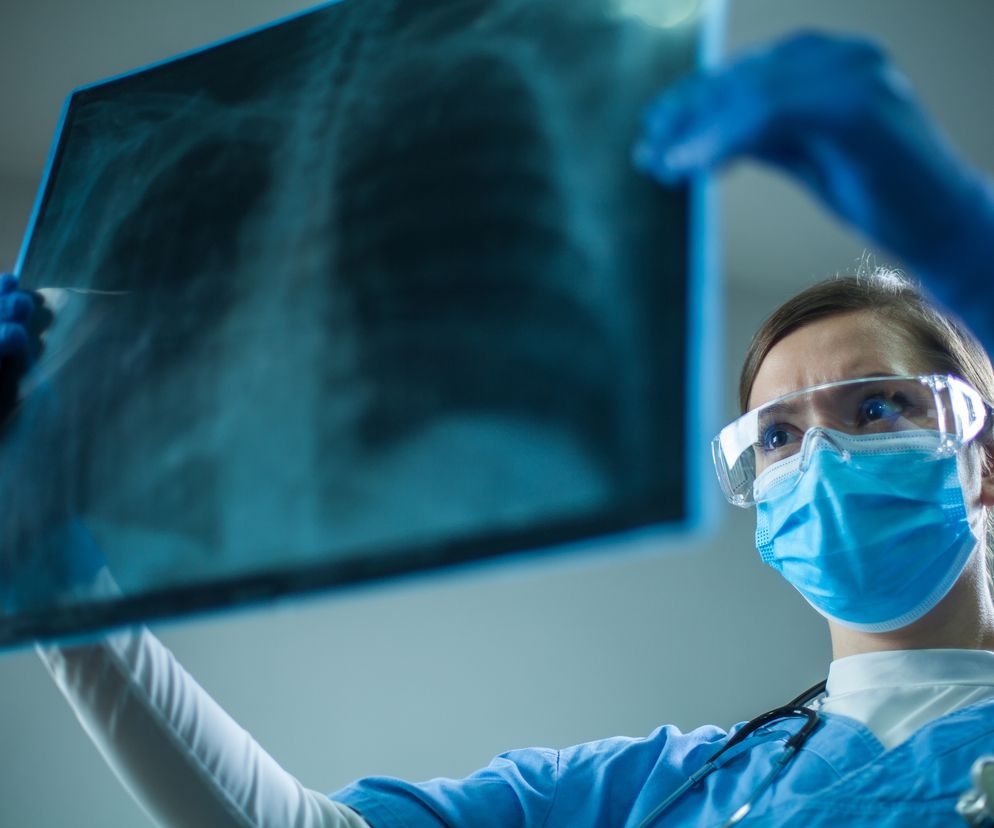 Lekarz trzymający zdjęcie rentgenowskie.