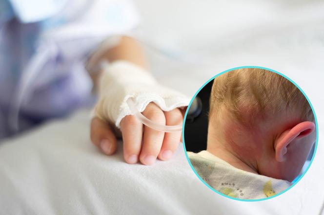 Zbliżenie na dziecko leżące w łóżku szpitalnym 