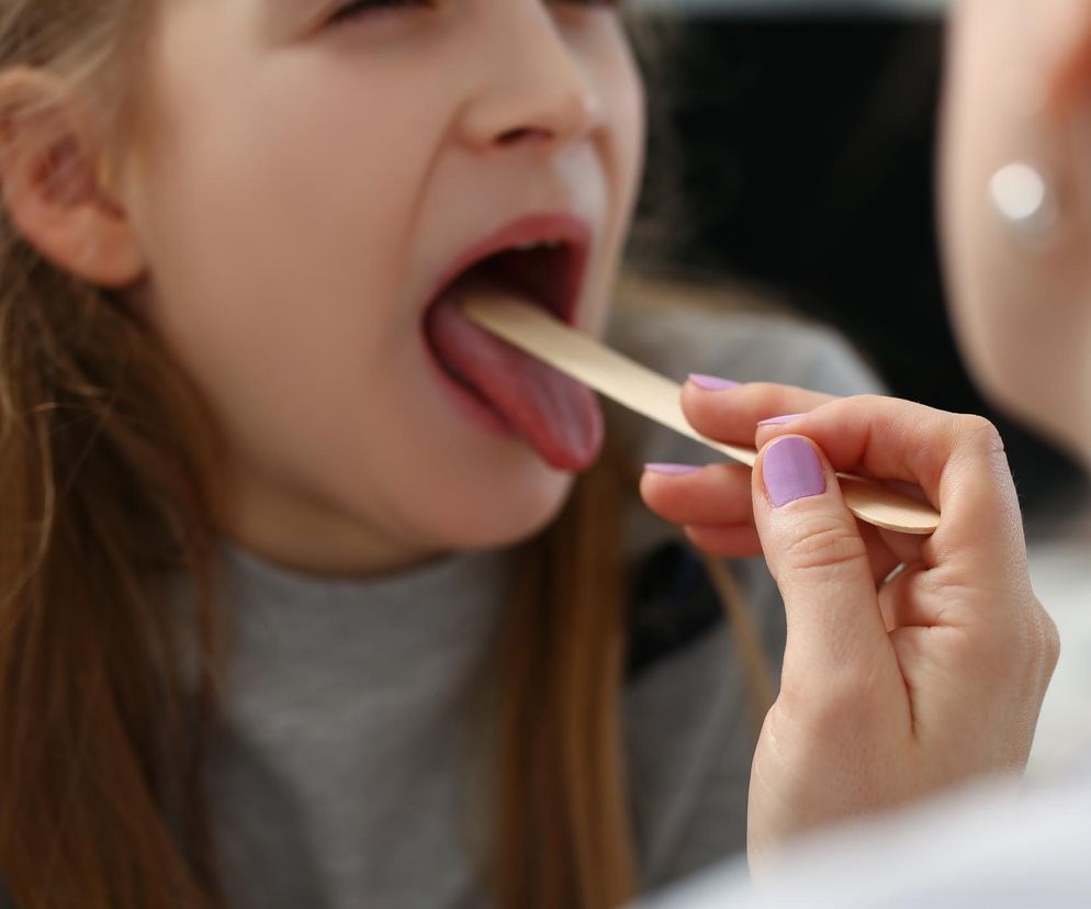 Tego nie jedz, gdy boli cię gardło. Posiłki, które mogą zaostrzać objawy