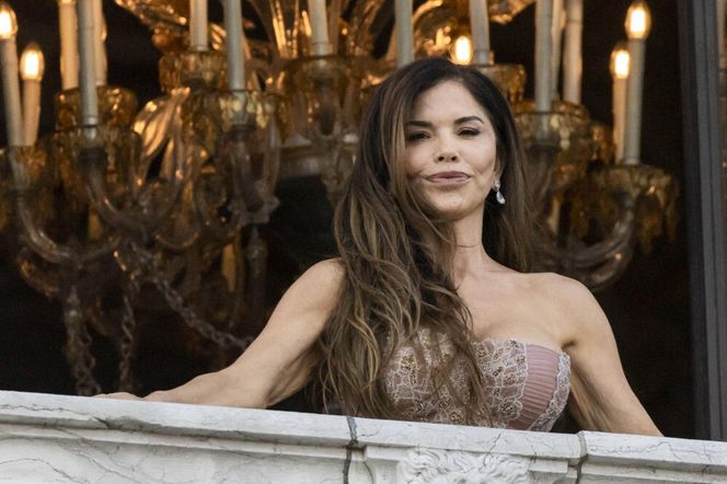 Chirurg plastyczny podniósł alarm. Chodzi o Lauren Sanchez!