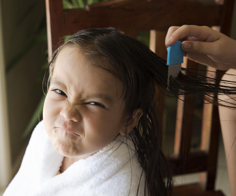 Wszy w szkole to problem tysięcy rodzin. Sanepid ostrzega: tego nie rób
