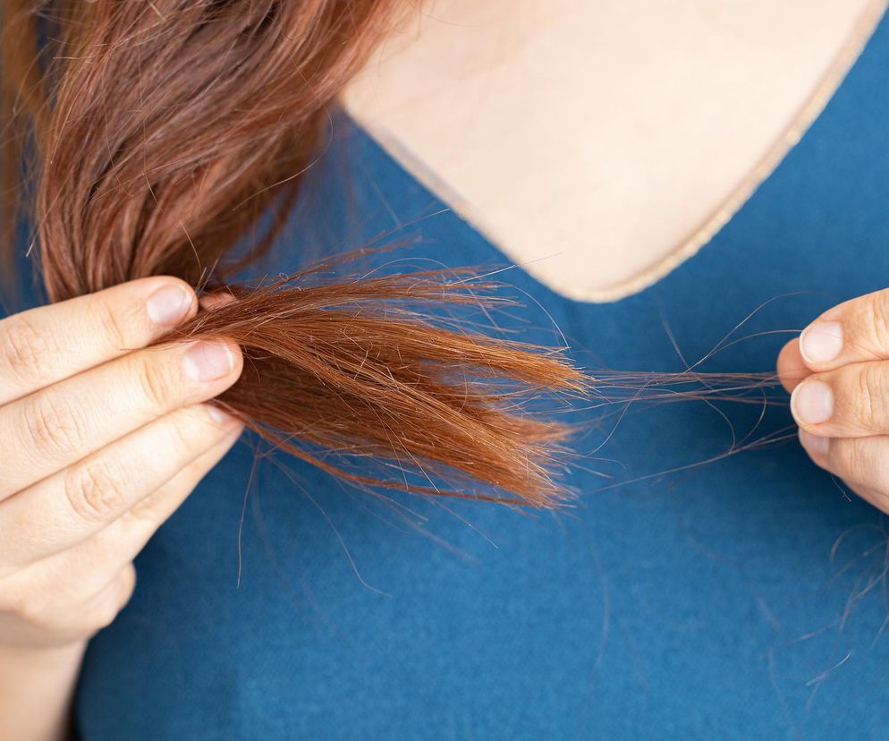 Dlaczego zimą wypadają i niszczą się włosy? Sposoby na poprawę kondycji włosów