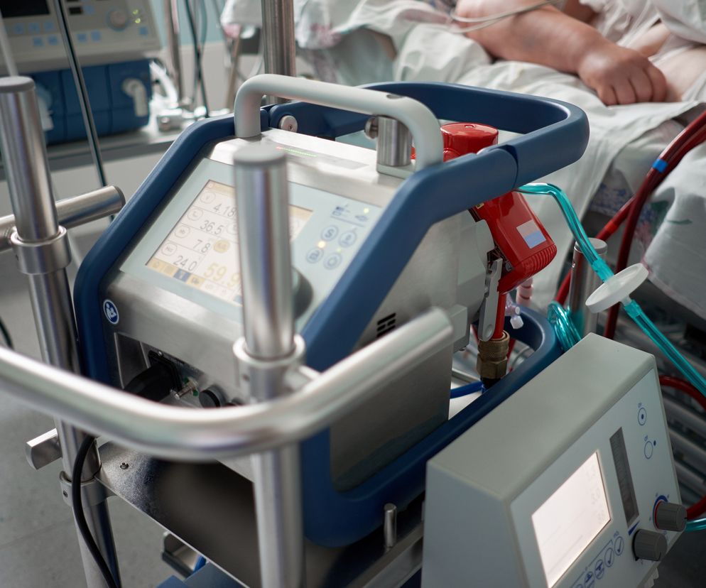 ECMO - co to jest? Wskazania i zastosowanie w medycynie