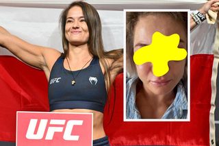 Polka brutalnie rozbita na UFC. Karolina Kowalkiewicz pokazała twarz po przyjęciu 142 ciosów