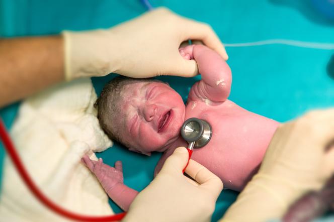 Jak wygląda noworodek po porodzie? To nie powinno cię dziwić w wyglądzie noworodka