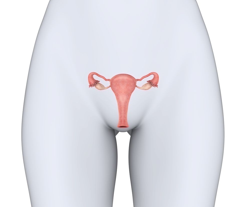 Zwężenie (zarośnięcie) ujścia zewnętrznego szyjki macicy