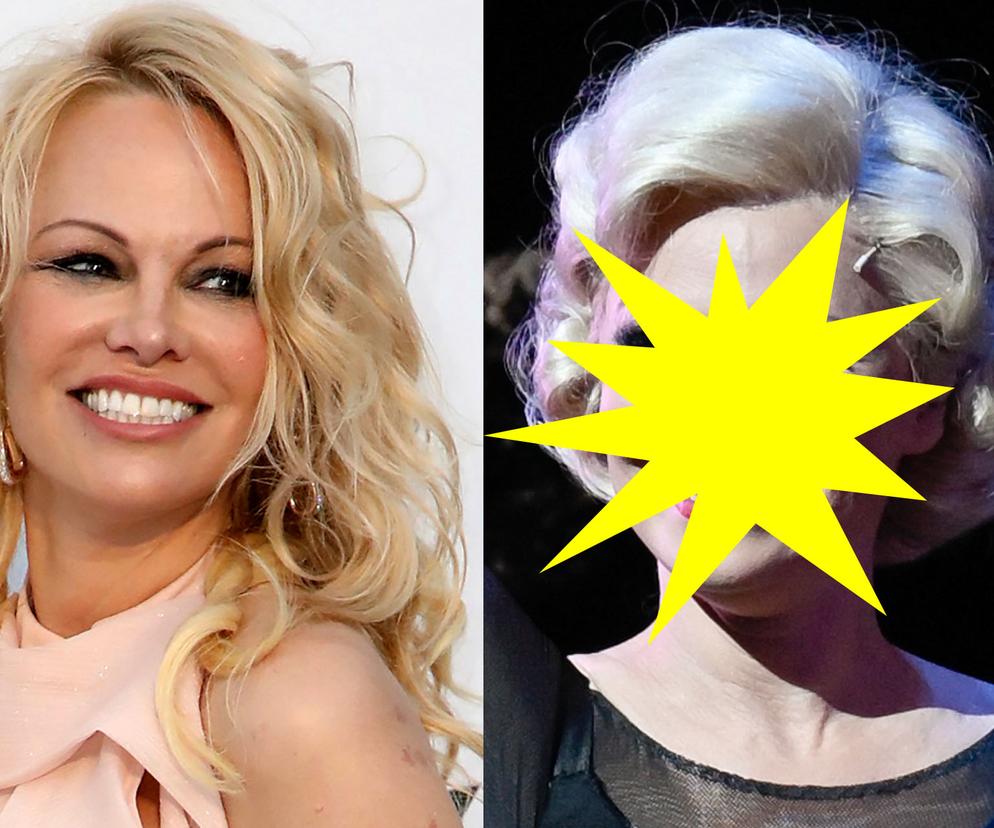  Pamela Anderson ma nową twarz? Szósty rozwód jej posłużył