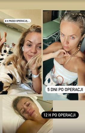 Dramat gwiazdy TVN. Anna Skura po operacji piersi