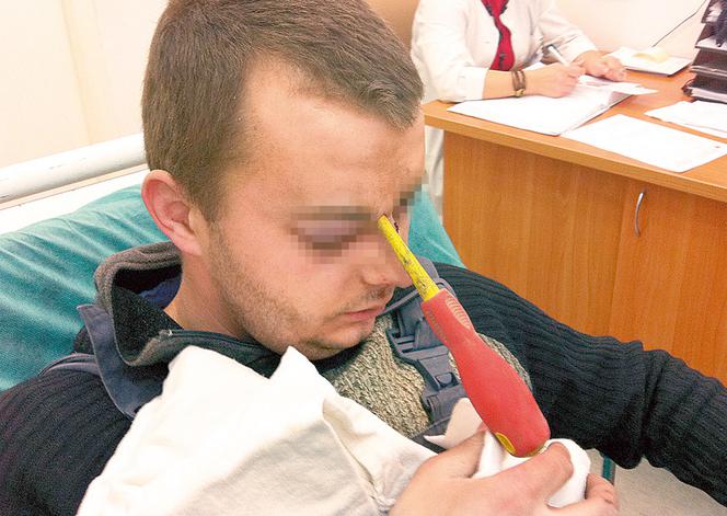 Wyciagneli mu śrubokręt z mózgu