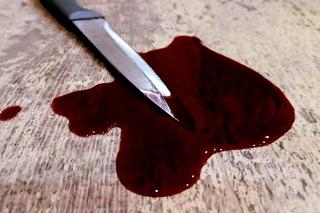 Kolejne dwie osoby zatrzymane po śmierci 31-latka dźgniętego nożem w Brodnicy. Sytuacja jest dynamiczna