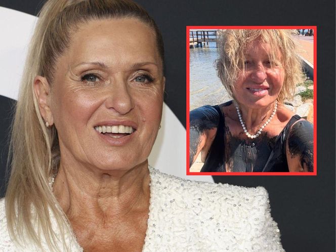 Ewa Kasprzyk na zabiegu błotnym