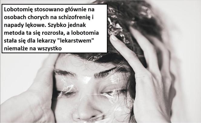 W tych przypadkach stosowano lobotomię