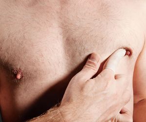 Te objawy mogą świadczyć o raku piersi u mężczyzn. Nie wolno ich ignorować