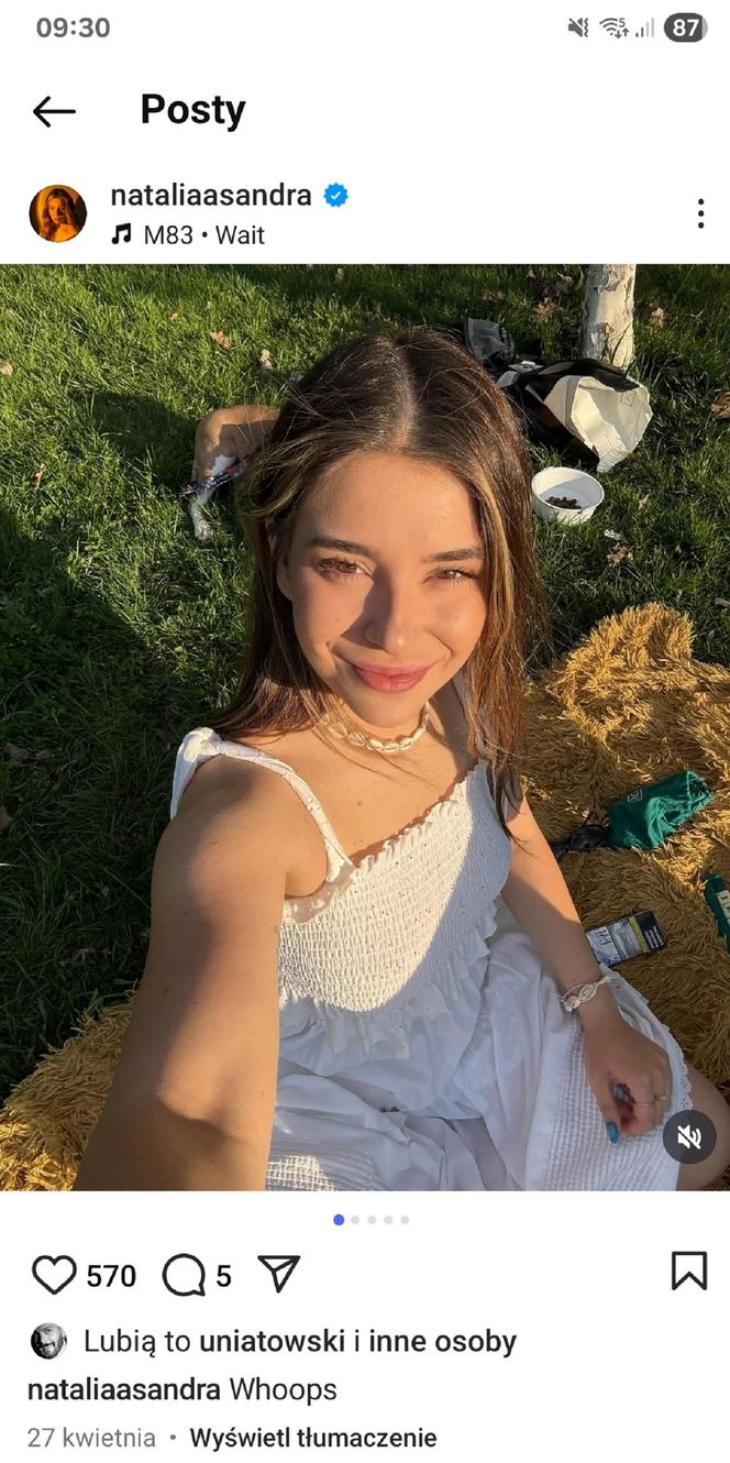 Natalia Zambrzycka (Agata z serialu Barwy szczęścia) powiększa sobie usta od lat